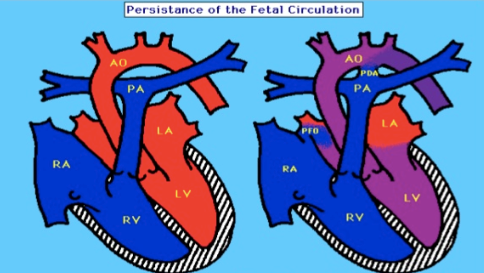 how long can dogs live with pulmonary hypertension