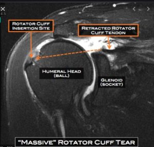 mri abnormal witness orthopedic surgeon